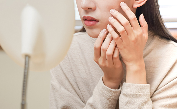 肌の赤みの原因と対策まとめ｜敏感肌向け乾燥を防ぐスキンケア術