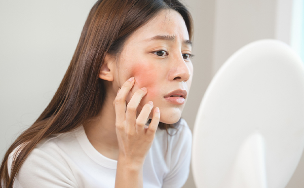 肌の赤みの原因と対策まとめ｜敏感肌向け乾燥を防ぐスキンケア術