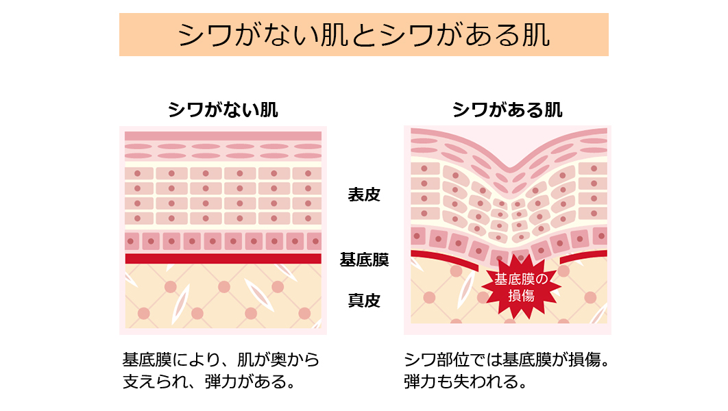 シワの跡を残さない、つくらない。シワ改善美容液で表情美人へ！